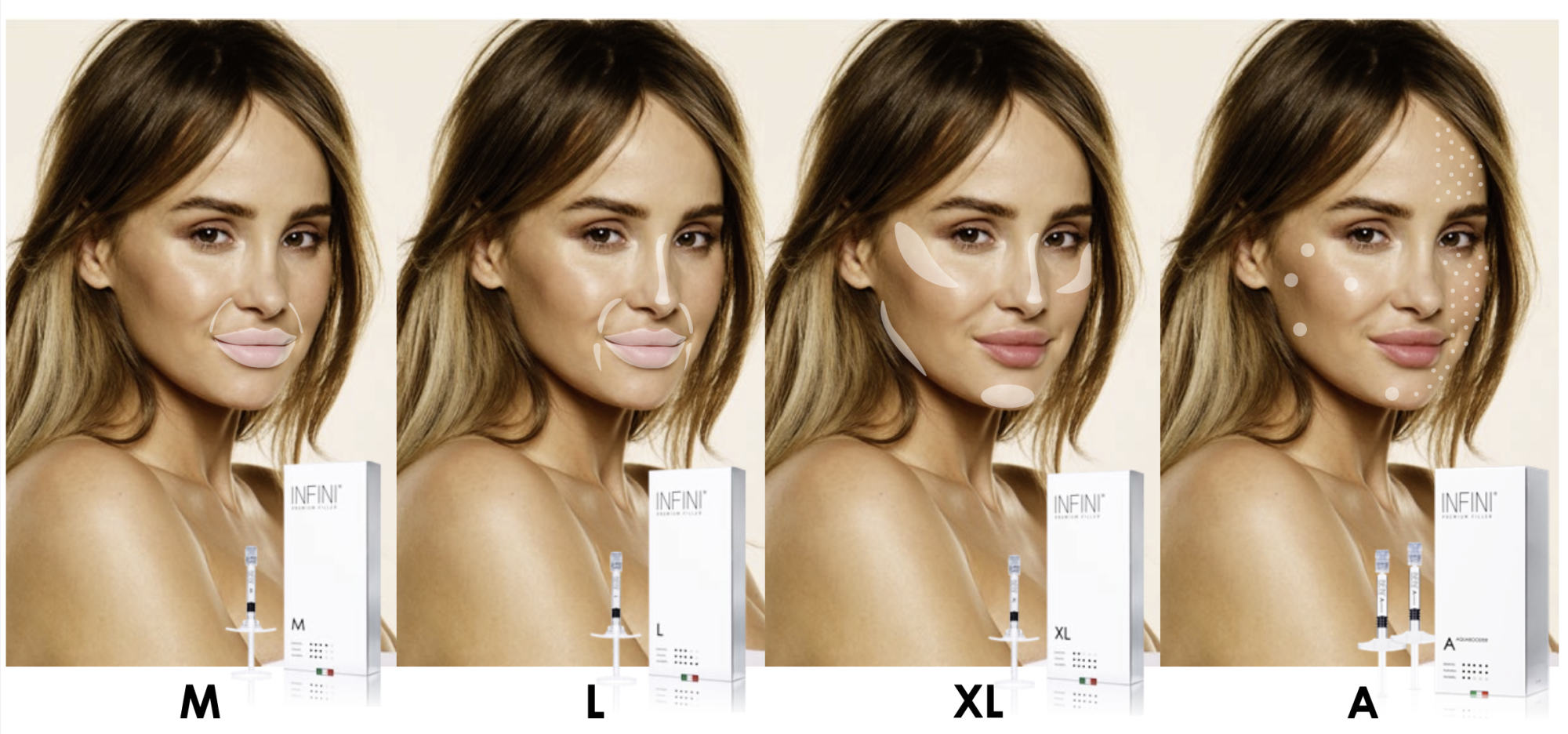 ddermalne vyplne, aquabooster, skinbooster, vital ijector, hydratácia pleti esteticka medicína, omladenie pleti, hydratačné ošetrenie