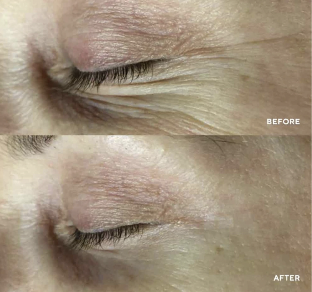 Stichprobe Gesichtsmaske Polypeptide Face Collagel 1 ks<br>Kollagen- und Feuchtigkeits-Gesichtsmaske mit Wirksamkeit bis auf zellulärer DNA-Ebene