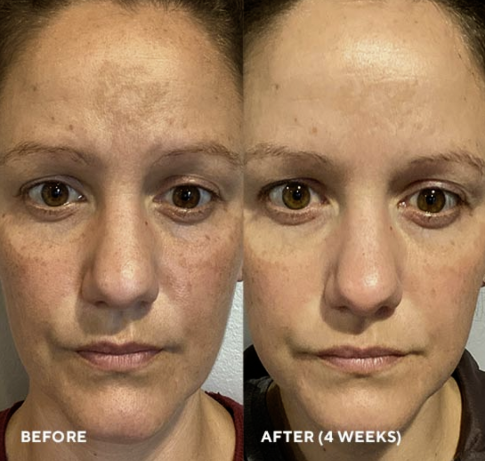 Firma Bright MiniBar 3ml<br>Anti-aging Gesichtspflege-Booster mit 20 % Vitamin C
