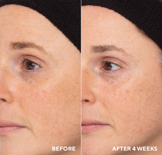 TRAVEL HYDROPEPTIDE RETINOL ROUTINE BOOSTER 
Retinol-Serum mit CellRenew-16 und Hyaluronsäure gegen Falten
