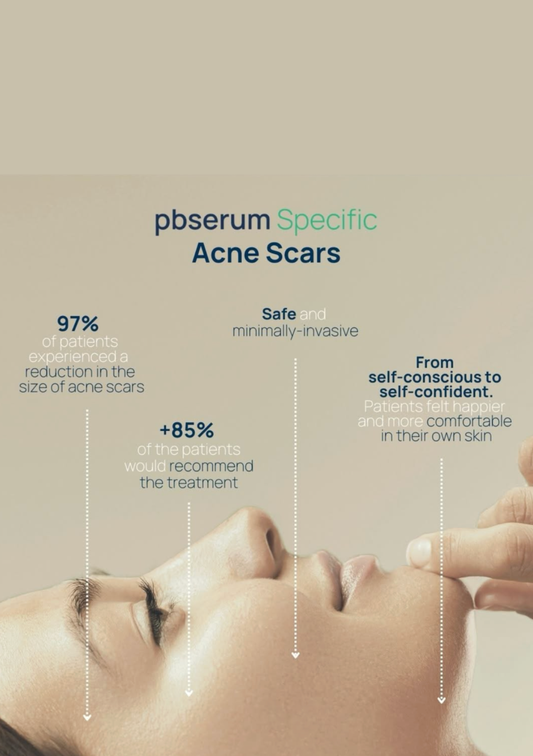 PBSERUM SPECIFIC ACNE SCARS HOME CARE 
Behandlung zur Milderung von Akne-Narben für die Heimanwendung