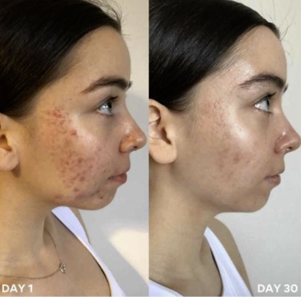 Gesichtsreinigung und Desinfektion<br>Clinisoothe+ Skin Purifier<br>100 ml