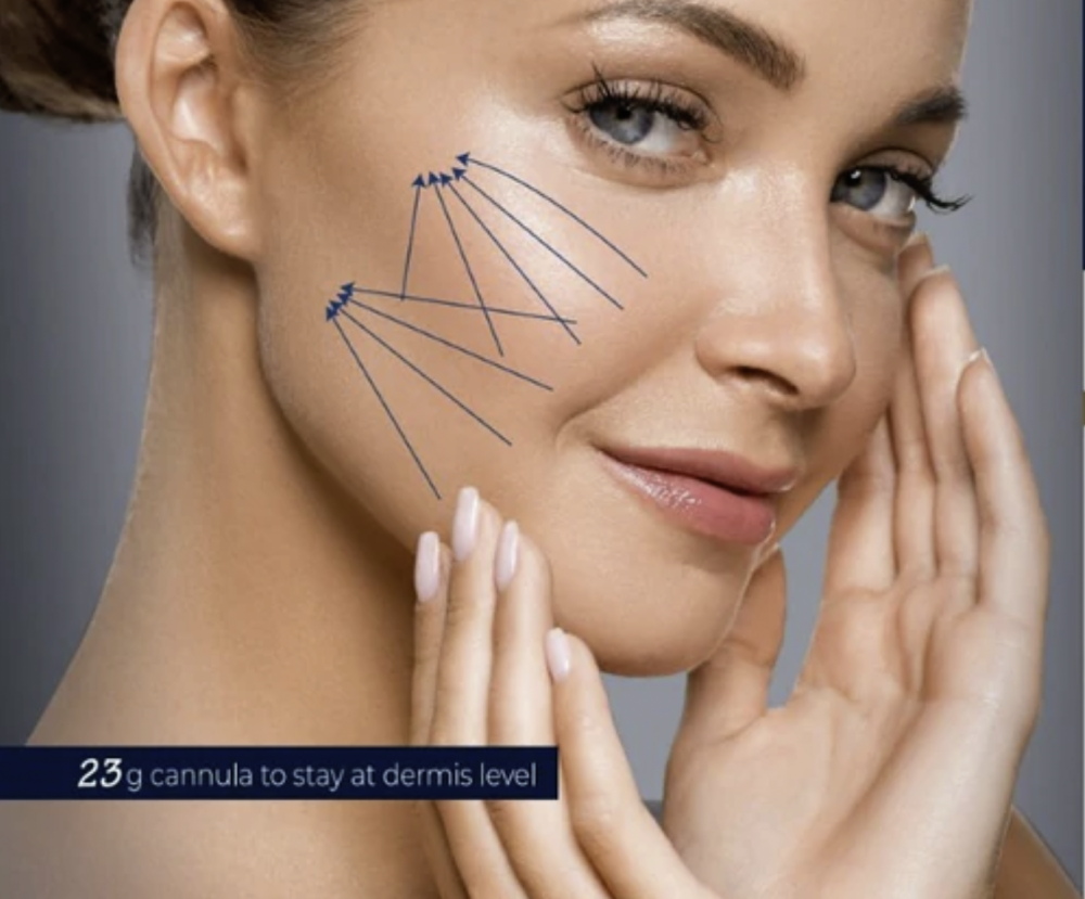 JALUPRO SUPER HYDRO - LIFTING LIGAMENT - BIORESTORATION OF SKIN 
Tiefenhydratisierung und Kollagen-Booster für das Gewebe auch für das Ligament - Vorbeugung gegen das Erschlaffen des Ligaments und Entfernung eines müden Gesichtsausdrucks.