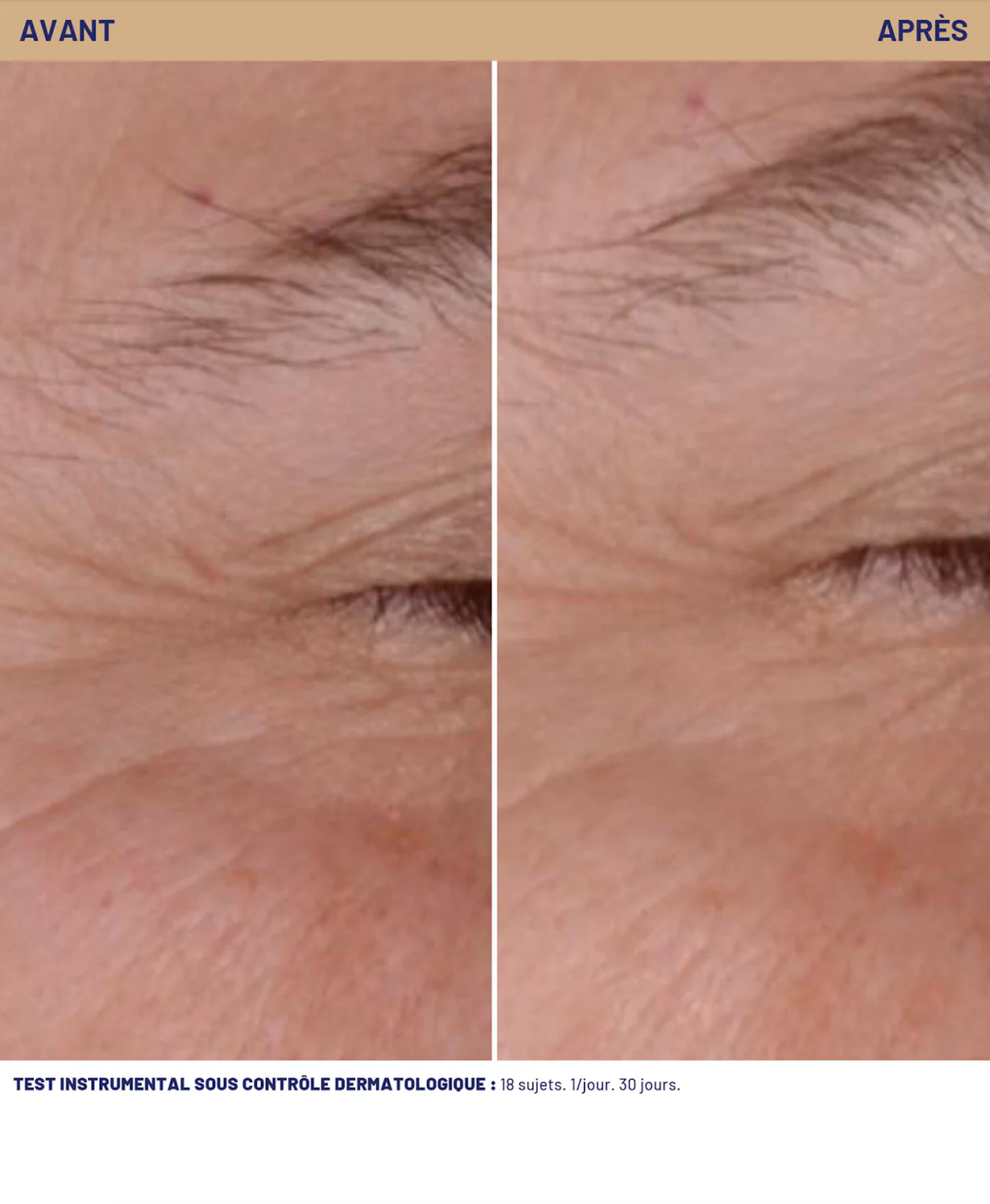 SOSKIN GLYCO C PIGMENT-WRINKLE CORRECTIVE CARE <br>EXP 04/26 Rabatt 80% 
Nachtcreme gegen Falten und Pigmentierungen 30 ml.