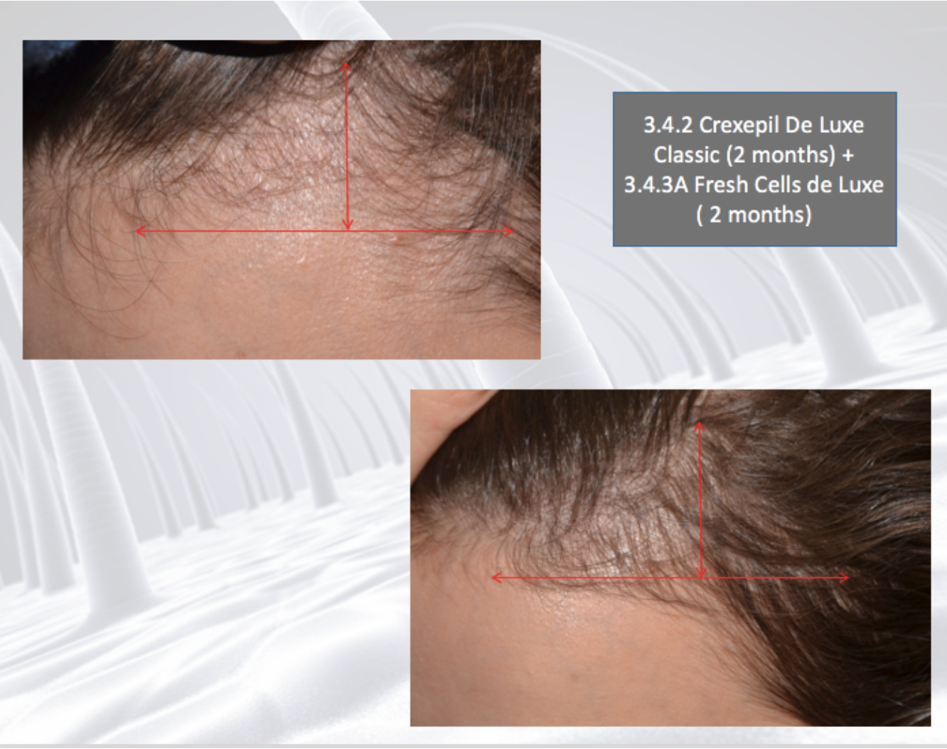 DSD SIMONE DE LUXE WONDERCELL LOTION 
3.4.3A Nährende Haarlotion für eine starke Haarwuchsstimulation