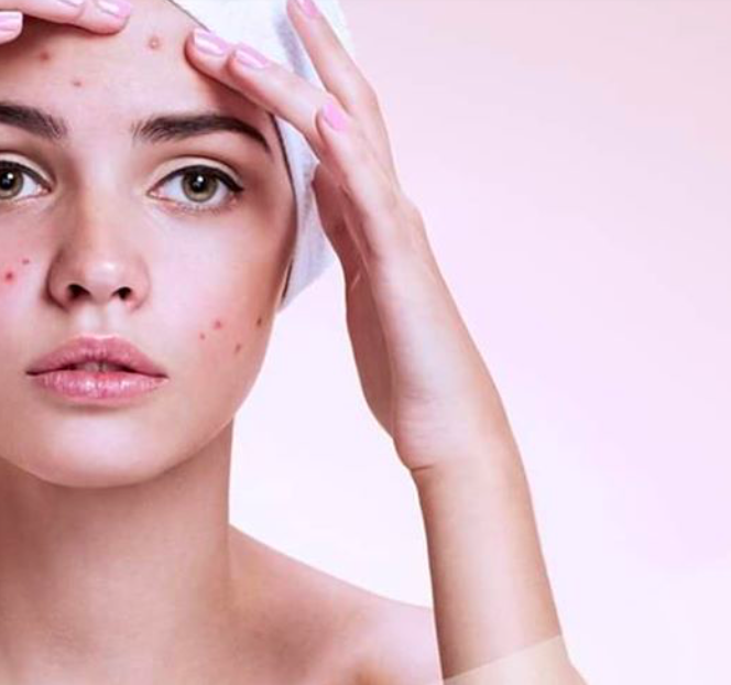 MD:CEUTICALS md:COMPLEX SKINCLEAR 
Akne, fettige Haut